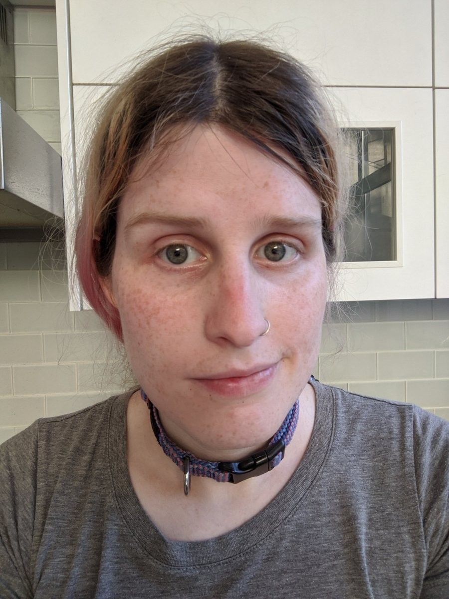 A not so slightly sunburned selfie of me